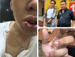 Penanganan Dugaan Penganiayaan Dinilai Berlarut, Orang Tua Korban Sambangi Polsek Tanjungkarang Timur